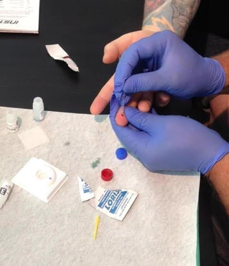 HIV-AIDS organizations fear federal funding shift will lead to higher ...